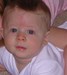
<p><strong>Salmon patch/Angel kiss</strong> on forehead. Photograph
taken at 5 months old. Now aged 6 only a slight shadow appears when
upset.</p>
