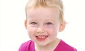 
<p><strong>Mixed malformation</strong><br />
Capillary malformation (port wine stain) left cheek and venous
malformation under left eye. Approx age in picture 2 years. Before
treatment.<br />
 <strong>3 of 4&nbsp;</strong></p>
