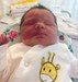
<p><strong>Capillary malformation (port wine
stain)</strong>&nbsp;<br />
On the right side of face.&nbsp;Photo taken when a few hours
old.<br />
 <strong>1 of 2&nbsp;</strong></p>
