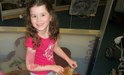 
<p><strong>Capillary malformation (port wine stain)<br />
</strong>On the right arm extending onto hand/chest and back.
Approx 6 years. No treatment.<br />
 <strong>1 of 3&nbsp;</strong></p>
