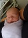 
<p><strong>Haemangioma bridge of nose<br />
</strong>Photo taken at 1 day old. Parents assumed it was an 'angel
kiss'<br />
<strong>1 of 3&nbsp;</strong></p>

